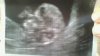 WIN_20151102_09_10_22_Pro.jpg