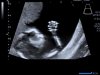 baby1.jpg