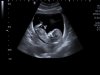 baby2.jpg