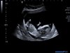 baby3.jpg