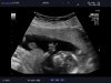 16 week echo (9).jpg