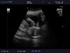 20 week echo (7).jpg