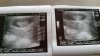 20151110_142142.jpg