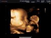BABY_0038.jpg