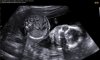 BABY_0003.jpg