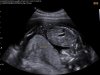 BABY_0008.jpg