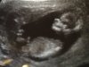 Baby a.jpg