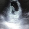 Mommytobe1