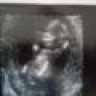 2nd baby wonder