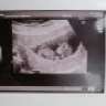 angelbaby1987