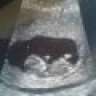 Noenie