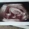 BabyGDjie