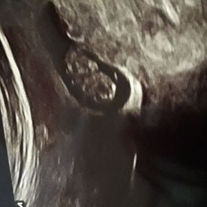 IMG-20180420-WA0001