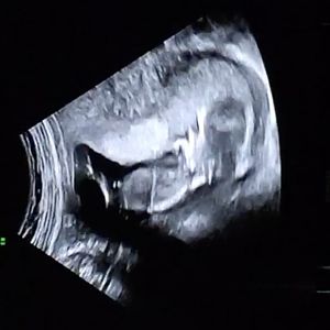 Echo1
