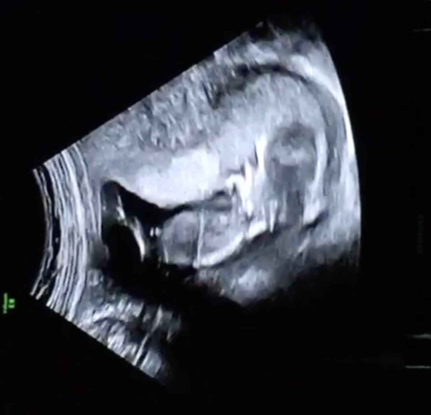 Echo1