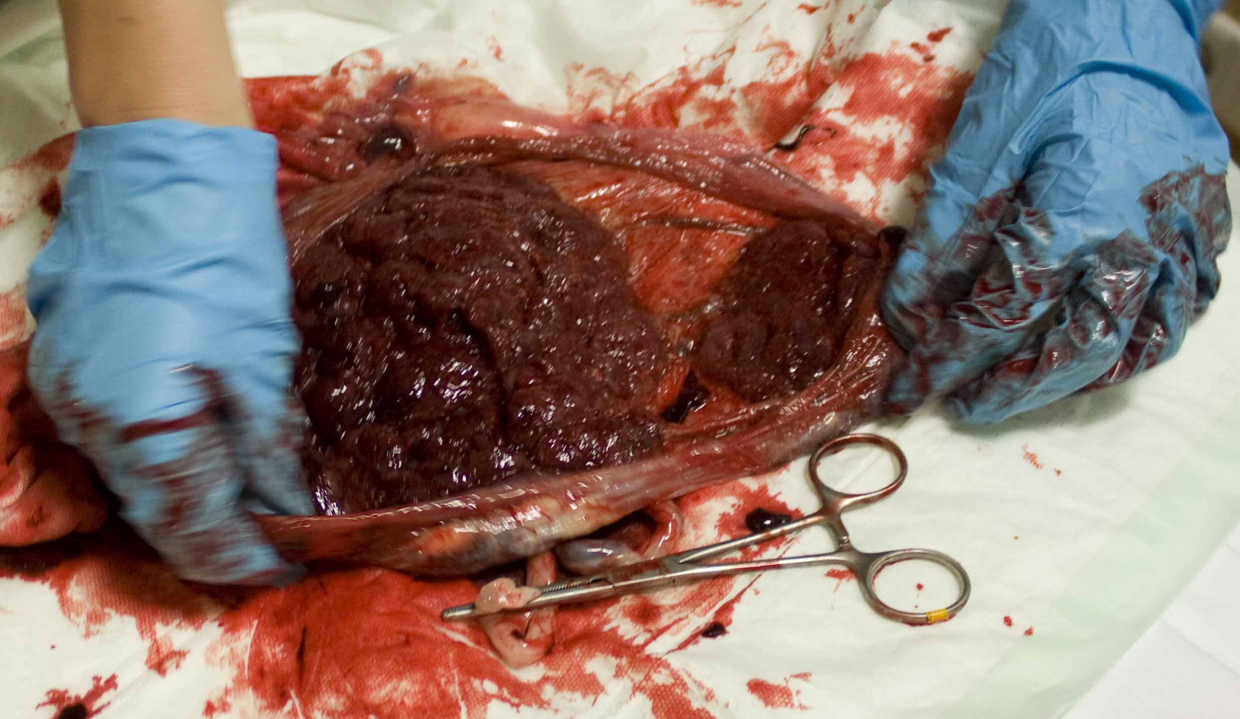 Placenta - 2 delen